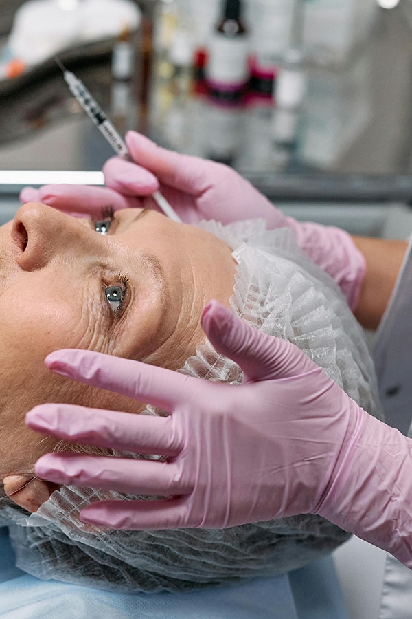 Botox injection areas around the eyes and forehead