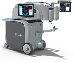 LENSAR Laser System at Price Vision Group