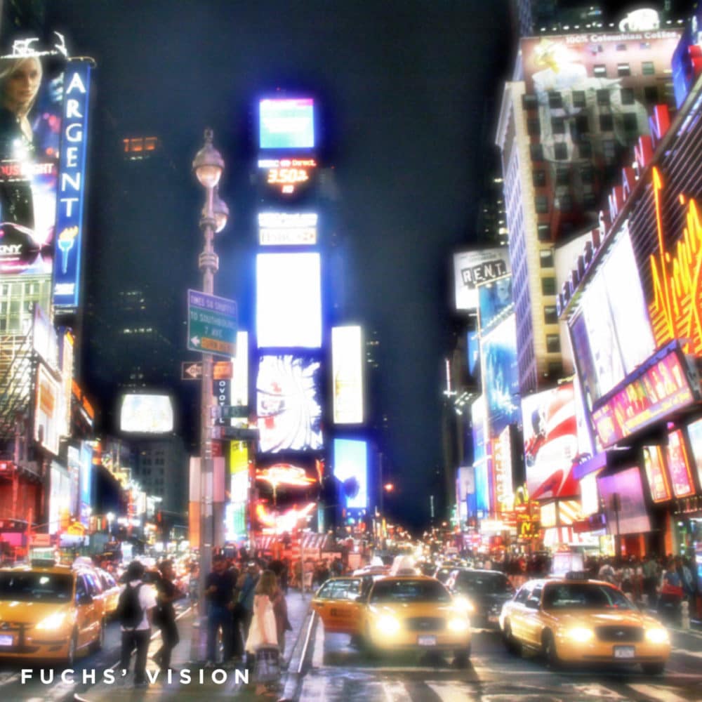 New York City seen with Fuchs’ Dystrophy before DMEK