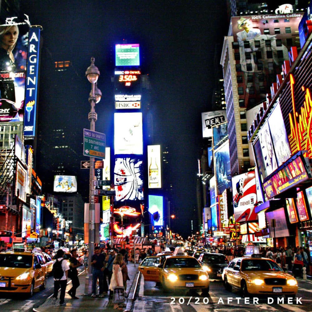 New York City seen after DMEK