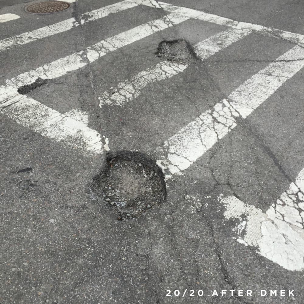 Potholes seen after DMEK
