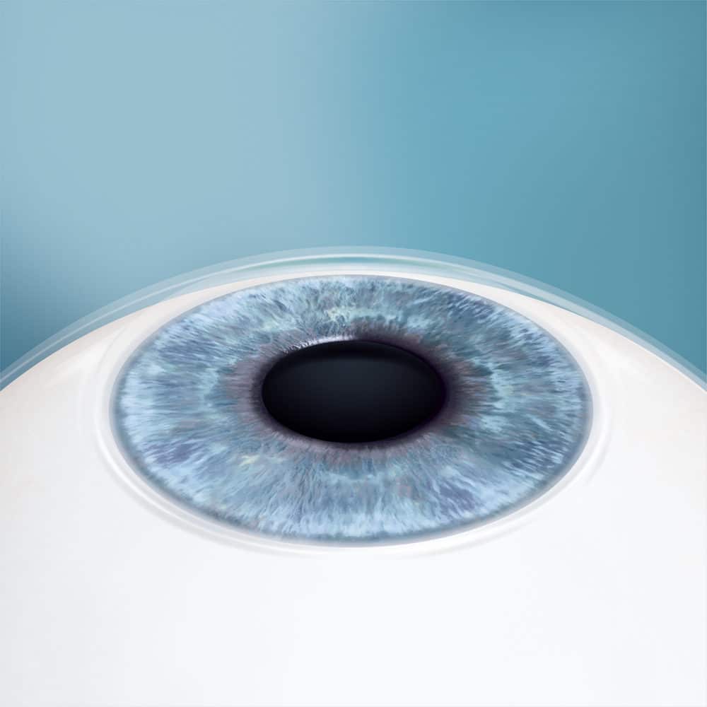 The lens in place with immediate results
