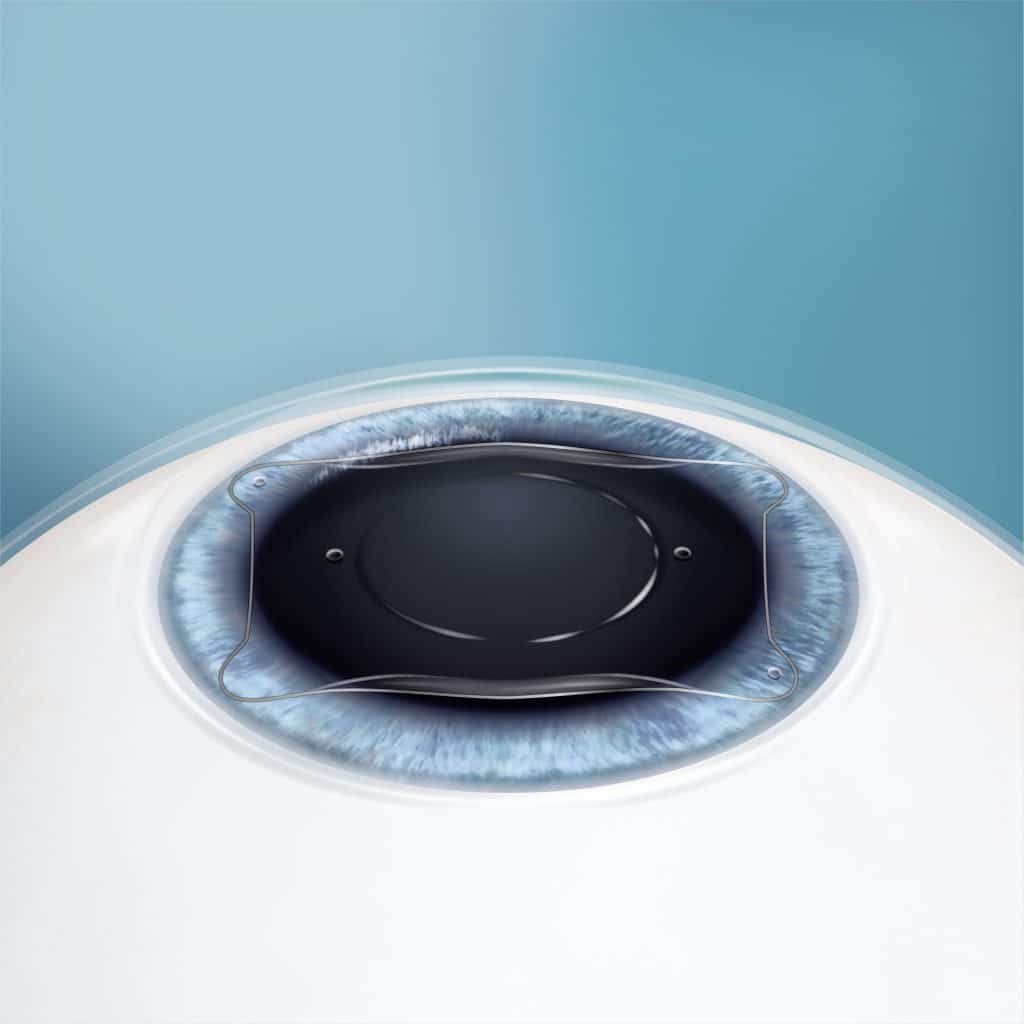 The lens tucked behind the iris