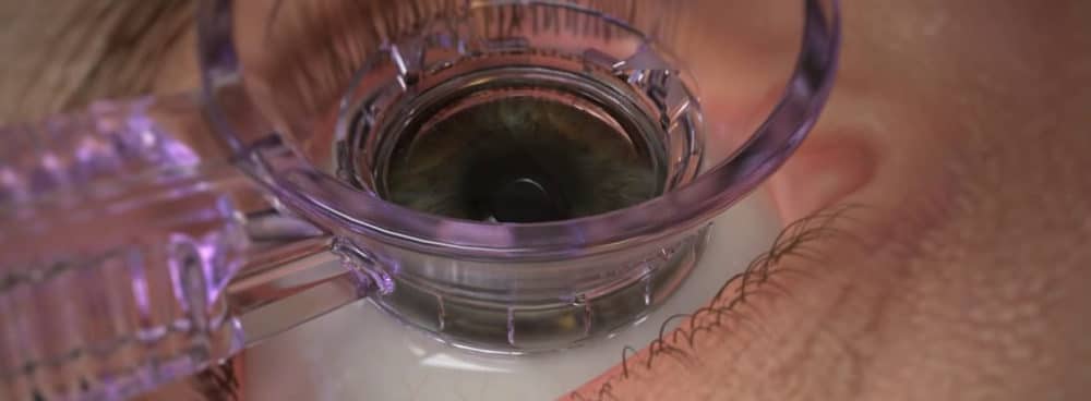 Femtosecond Laser