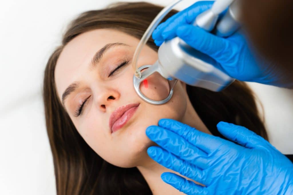Laser light treatment on the face