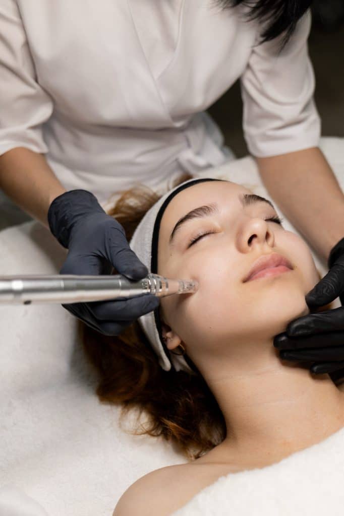 Microneedling skin treatment