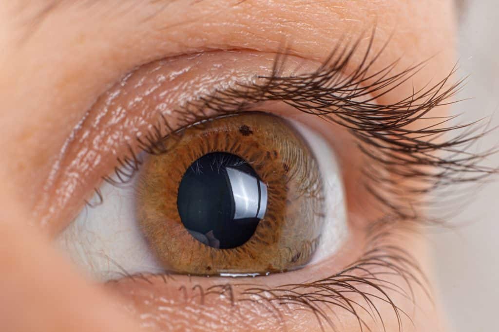Learn more about Artificial Cornea Transplant at Price Vision Group