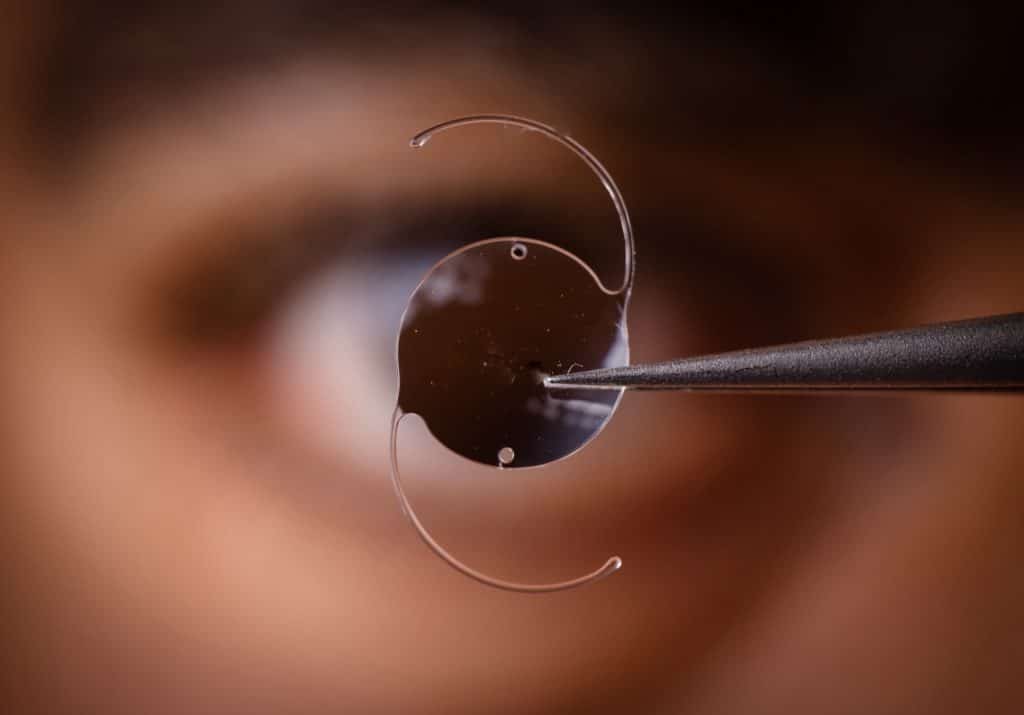Learn more about Refractive Lens Exchange RLE at Price Vision Group