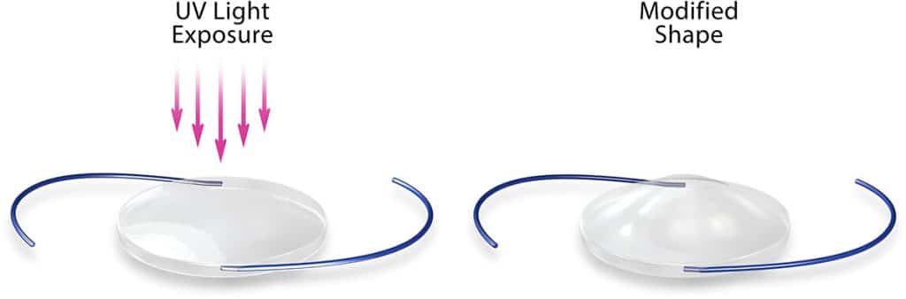 How does Light Adjustable Lens work?